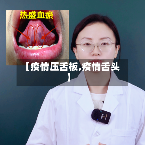 【疫情压舌板,疫情舌头】