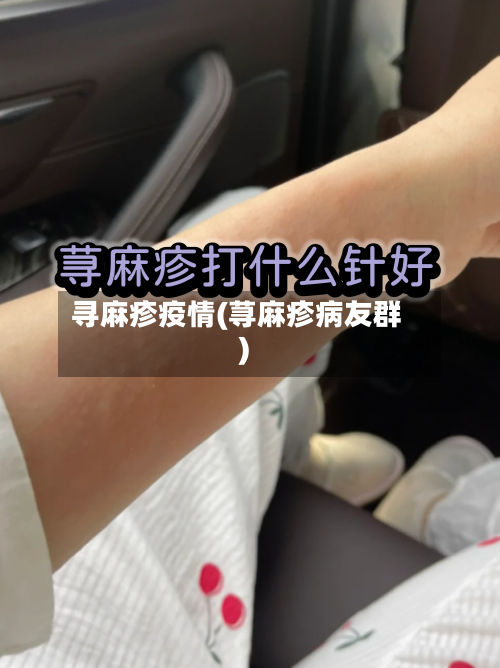 寻麻疹疫情(荨麻疹病友群)