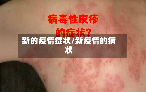 新的疫情症状/新疫情的病状-第2张图片