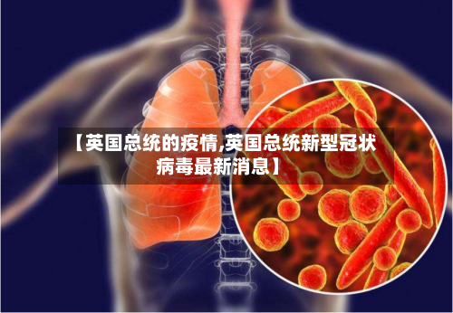 【英国总统的疫情,英国总统新型冠状病毒最新消息】
