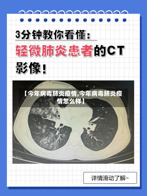 【今年病毒肺炎疫情,今年病毒肺炎疫情怎么样】-第2张图片