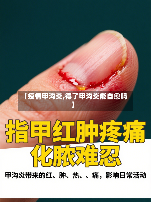 【疫情甲沟炎,得了甲沟炎能自愈吗】