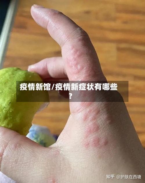 疫情新馆/疫情新症状有哪些?