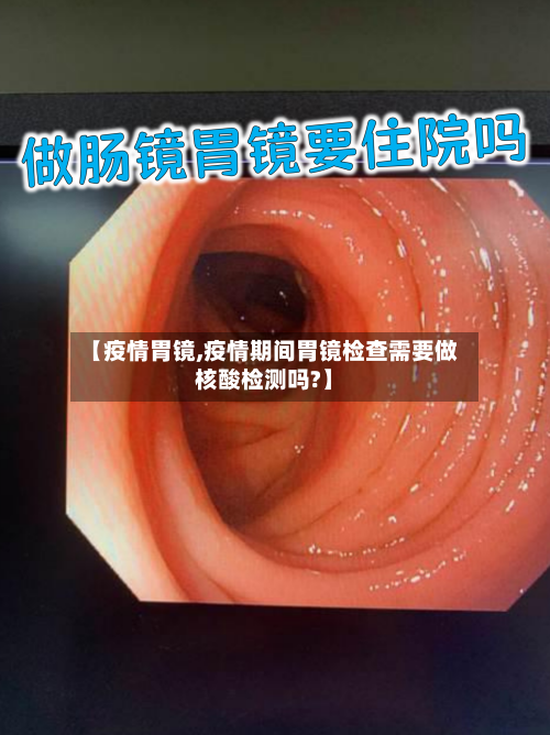 【疫情胃镜,疫情期间胃镜检查需要做核酸检测吗?】