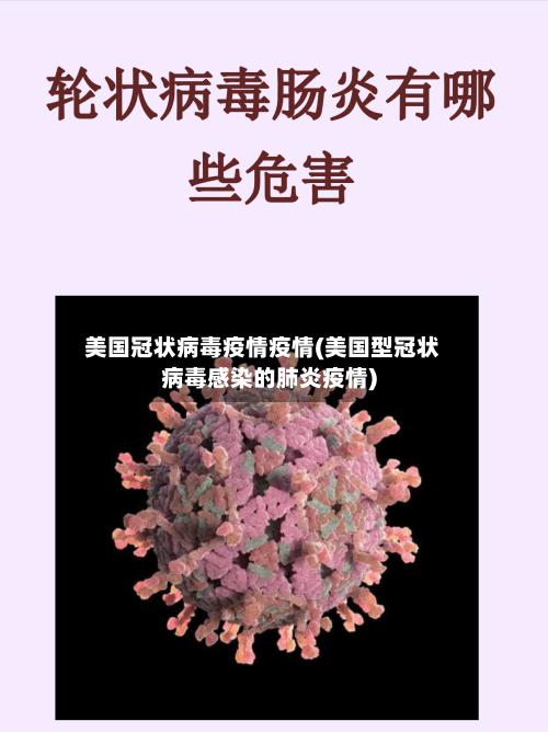 美国冠状病毒疫情疫情(美国型冠状病毒感染的肺炎疫情)-第3张图片