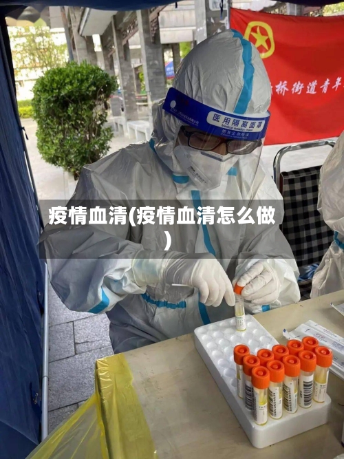 疫情血清(疫情血清怎么做)-第2张图片