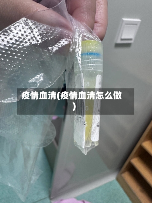 疫情血清(疫情血清怎么做)